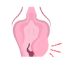 Itching around your vulva